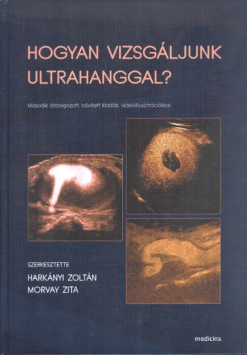 Hogyan vizsgáljunk ultrahanggal?